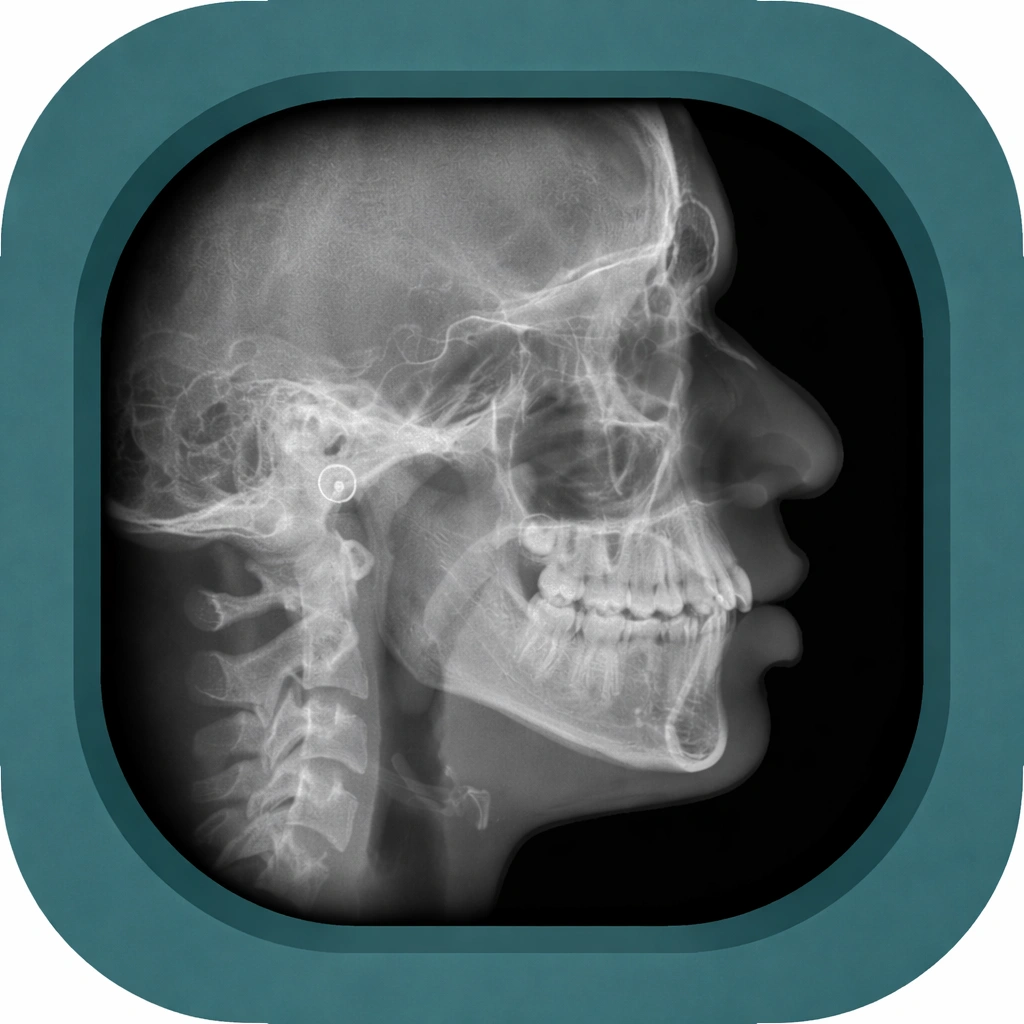 cephalogram x ray anatomy image